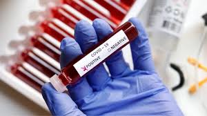 ଭାରତରେ ହ୍ରାସ ପାଇଛି କୋଭିଡ-୧୯ ମାମଲା: ବିପଦ, ନୂତନ ଲକ୍ଷଣ ଏବଂ ସୁରକ୍ଷା ବିଷୟରେ କ’ଣ କୁହନ୍ତି ଡାକ୍ତର